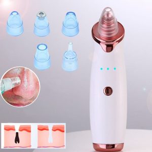 Limpiador Facial – Removedor De Espinillas Eléctrico – Limpiador de cara – Dermoabrasión Por Succión Al Vacío
